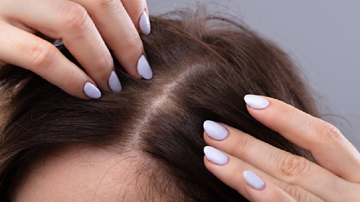 Four ways women can deal with thinning hair